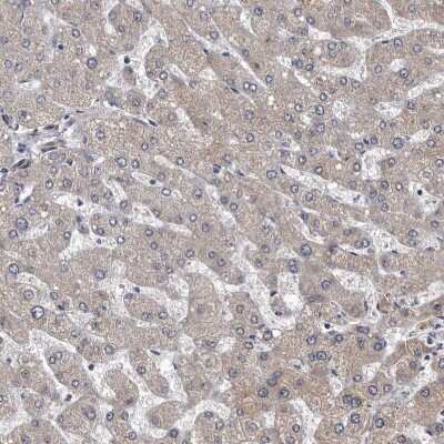 Immunohistochemistry-Paraffin: CD133 Antibody [NBP2-59789]