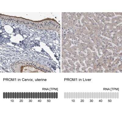 Immunohistochemistry-Paraffin: CD133 Antibody [NBP2-59789]