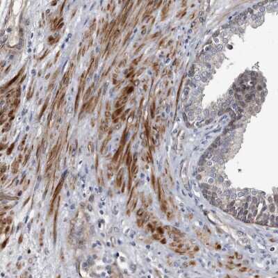 Immunohistochemistry-Paraffin: CD133 Antibody [NBP2-59789]