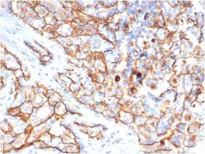 Immunohistochemistry-Paraffin: CD133 Antibody (PROM/6316) - Azide and BSA Free [NBP3-08969]