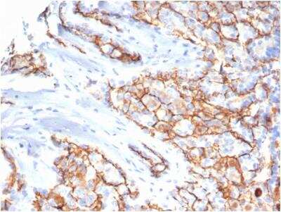 Immunohistochemistry: CD133 Antibody (PROM/6316) [NBP3-07898]