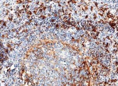 Immunohistochemistry-Paraffin: CD14 Antibody (001) [NBP2-89259]