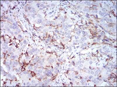 Immunohistochemistry: CD14 Antibody (1H5D8) - BSA Free [NBP2-37295]