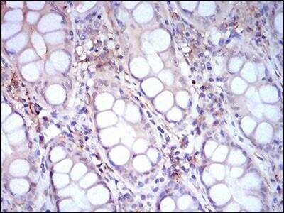 Immunohistochemistry: CD14 Antibody (1H5D8) - BSA Free [NBP2-37295]