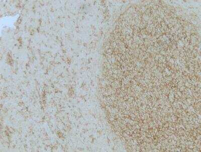 Immunohistochemistry-Paraffin: CD14 Antibody (1H5D8) - BSA Free [NBP2-37295]