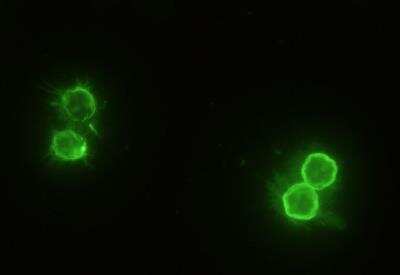 Immunocytochemistry/ Immunofluorescence: CD14 Antibody (503) [NBP2-90362]