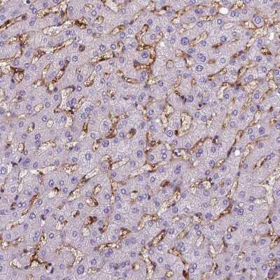 Immunohistochemistry-Paraffin: CD14 Antibody (CL1638) [NBP2-34486]