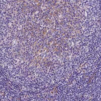 Immunohistochemistry-Paraffin: CD14 Antibody (CL1638) [NBP2-34486]