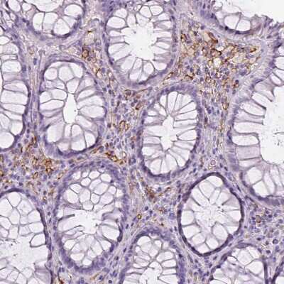 Immunohistochemistry-Paraffin: CD14 Antibody (CL1638) [NBP2-34486]
