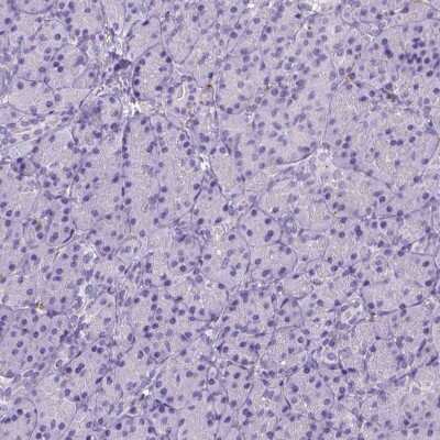 Immunohistochemistry-Paraffin: CD14 Antibody (CL1638) [NBP2-34486]