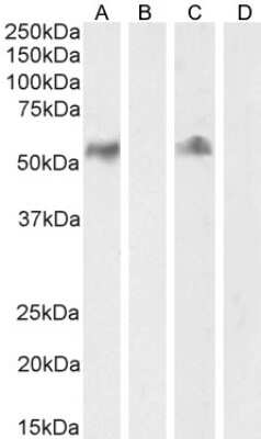 Western Blot: CD14 Antibody [NB100-2807]