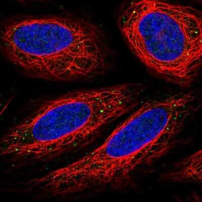 Immunocytochemistry/ Immunofluorescence: CD14 Antibody [NBP1-86168]