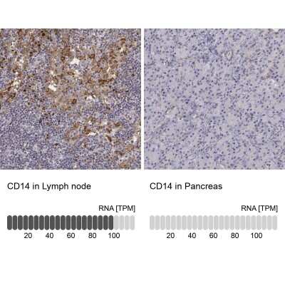 Immunohistochemistry-Paraffin: CD14 Antibody [NBP1-86166]