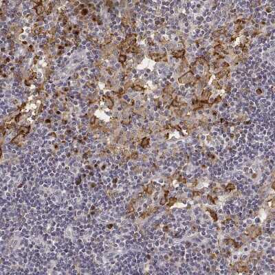 Immunohistochemistry-Paraffin: CD14 Antibody [NBP1-86166]