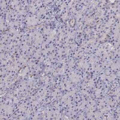 Immunohistochemistry-Paraffin: CD14 Antibody [NBP1-86166]