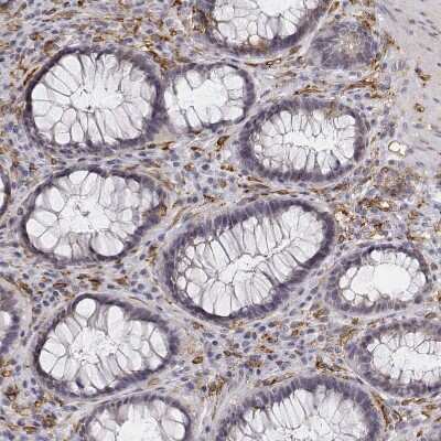 Immunohistochemistry-Paraffin: CD14 Antibody [NBP1-86166]