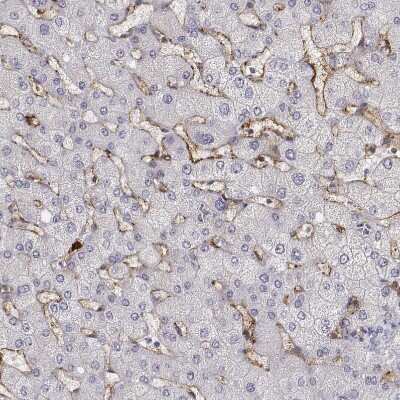Immunohistochemistry-Paraffin: CD14 Antibody [NBP1-86166]