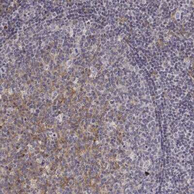 Immunohistochemistry-Paraffin: CD14 Antibody [NBP1-86166]