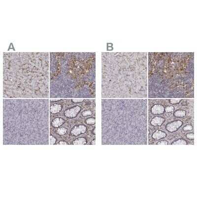 Immunohistochemistry-Paraffin: CD14 Antibody [NBP1-86168]