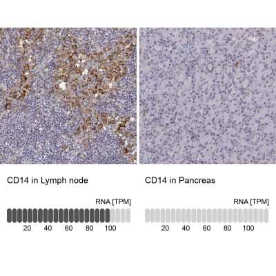 Immunohistochemistry-Paraffin: CD14 Antibody [NBP1-86168]