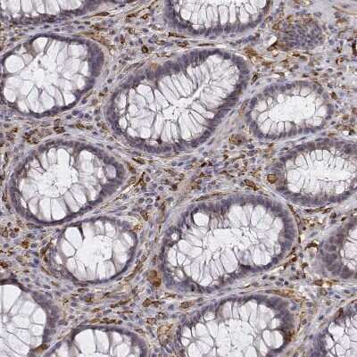 Immunohistochemistry-Paraffin: CD14 Antibody [NBP1-86168]