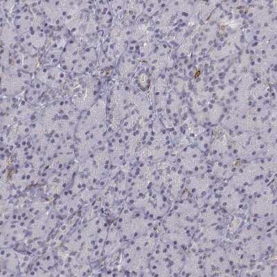 Immunohistochemistry-Paraffin: CD14 Antibody [NBP1-86168]