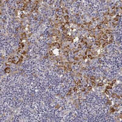 Immunohistochemistry-Paraffin: CD14 Antibody [NBP1-86168]