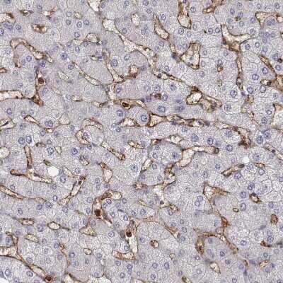 Immunohistochemistry-Paraffin: CD14 Antibody [NBP1-86168]