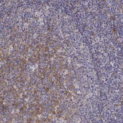 Immunohistochemistry-Paraffin: CD14 Antibody [NBP1-86168]