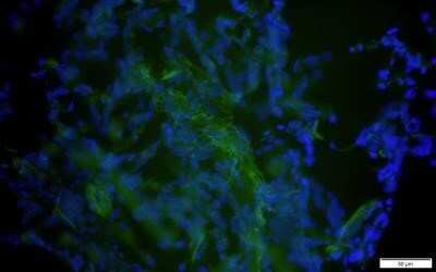 Immunocytochemistry/ Immunofluorescence: CD14 Antibody (M5E2) - BSA Free [NB100-77758]