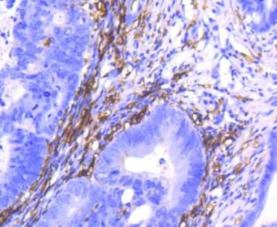 Immunohistochemistry-Paraffin: CD14 Antibody (SC69-02) [NBP2-67630]