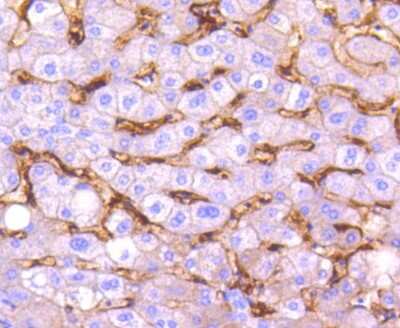 Immunohistochemistry-Paraffin: CD14 Antibody (SC69-02) [NBP2-67630]