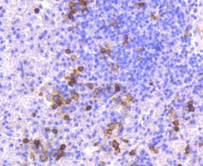 Immunohistochemistry-Paraffin: CD14 Antibody (SC69-02) [NBP2-67630]