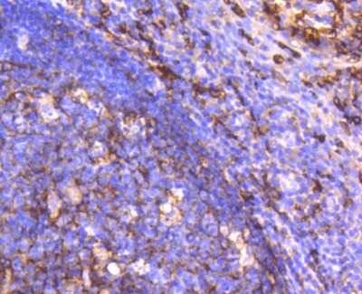 Immunohistochemistry-Paraffin: CD14 Antibody (SC69-02) [NBP2-67630]