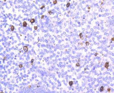 Immunohistochemistry-Paraffin: CD14 Antibody (SC69-02) [NBP2-67630]