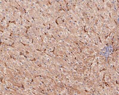 Immunohistochemistry-Paraffin: CD14 Antibody (SC69-02) [NBP2-67630]