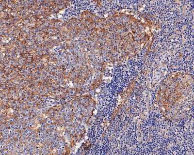 Immunohistochemistry-Paraffin: CD14 Antibody (SC69-02) [NBP2-67630]