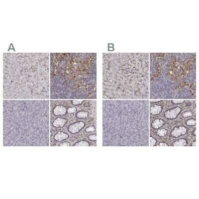 Immunohistochemistry-Paraffin: CD14 Antibody [NBP1-86166]