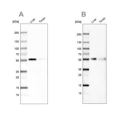 Western Blot: CD14 Antibody [NBP1-86166]