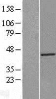 Western Blot: CD14 Overexpression Lysate [NBL1-08905]