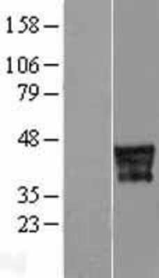 Western Blot: CD14 Overexpression Lysate [NBL1-08906]