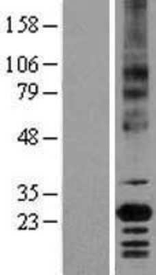 Western Blot: EMMPRIN/CD147 Overexpression Lysate [NBL1-08036]