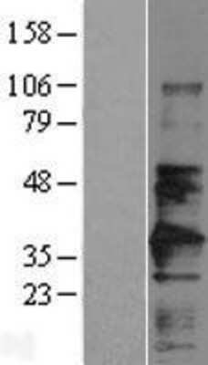 Western Blot: EMMPRIN/CD147 Overexpression Lysate [NBL1-08037]