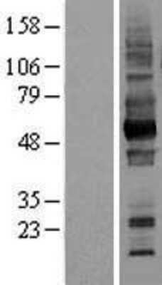 Western Blot: EMMPRIN/CD147 Overexpression Lysate [NBL1-08038]