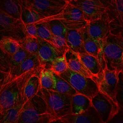 Immunocytochemistry/ Immunofluorescence: SSEA-1 Antibody (4E10) - BSA Free [NBP2-22179]