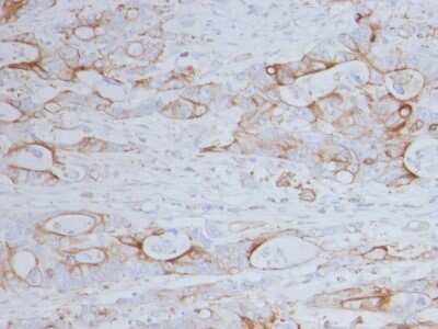 Immunohistochemistry-Paraffin: CD151 Antibody (11G5a) - Azide and BSA Free [NBP3-08797]