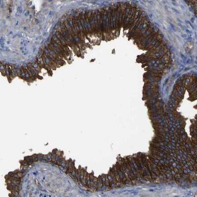 Immunohistochemistry-Paraffin: CD151 Antibody [NBP1-80924]