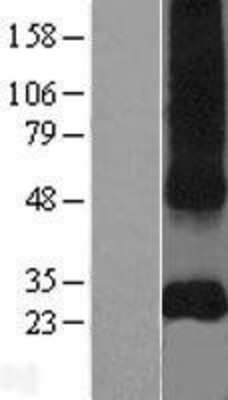 Western Blot: CD151 Overexpression Lysate [NBP2-09202]