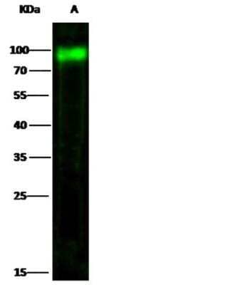 Western Blot: CD155/PVR Antibody (114) [NBP2-89272]