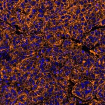 Immunohistochemistry-Paraffin: CD155/PVR Antibody (BLR074G) [NBP2-78711]
